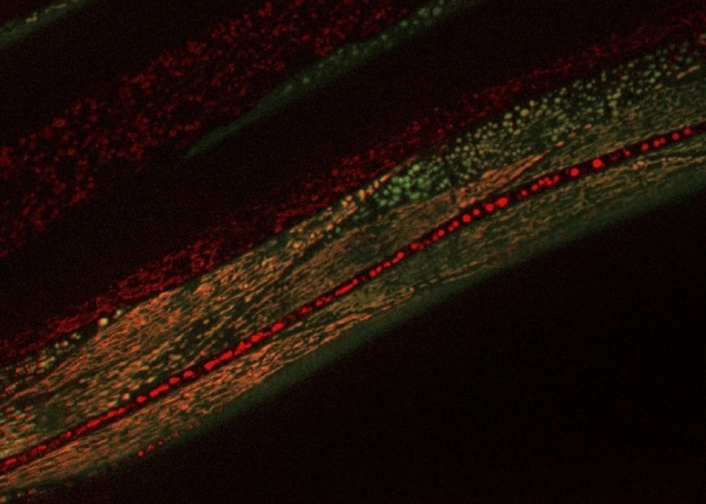 Fluorescently labeled mitochondria in the muscles of C. elegans