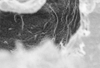 What underlies leptin resistance?