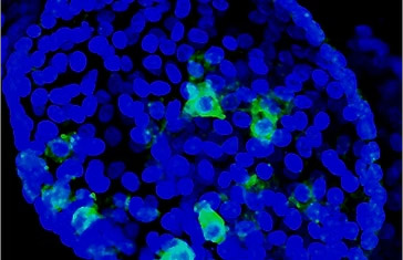 Organelle