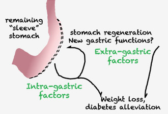 How does the stomach respond to sleeve gastrectomy?