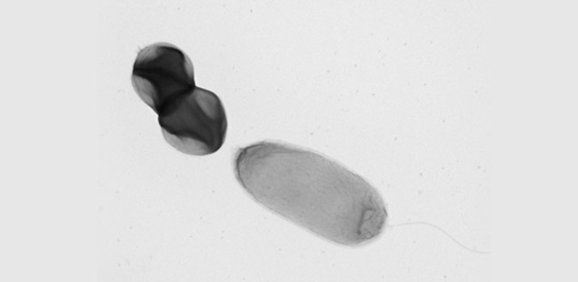 Pseudomonas aeruginosa (on the right) and Staphylococcus aureus (on the left) that were grown in co-culture.